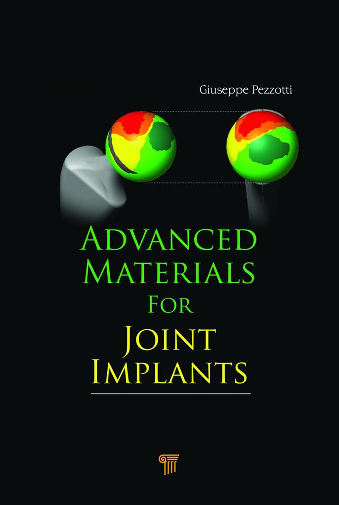 Advanced Materials for Joint Implants