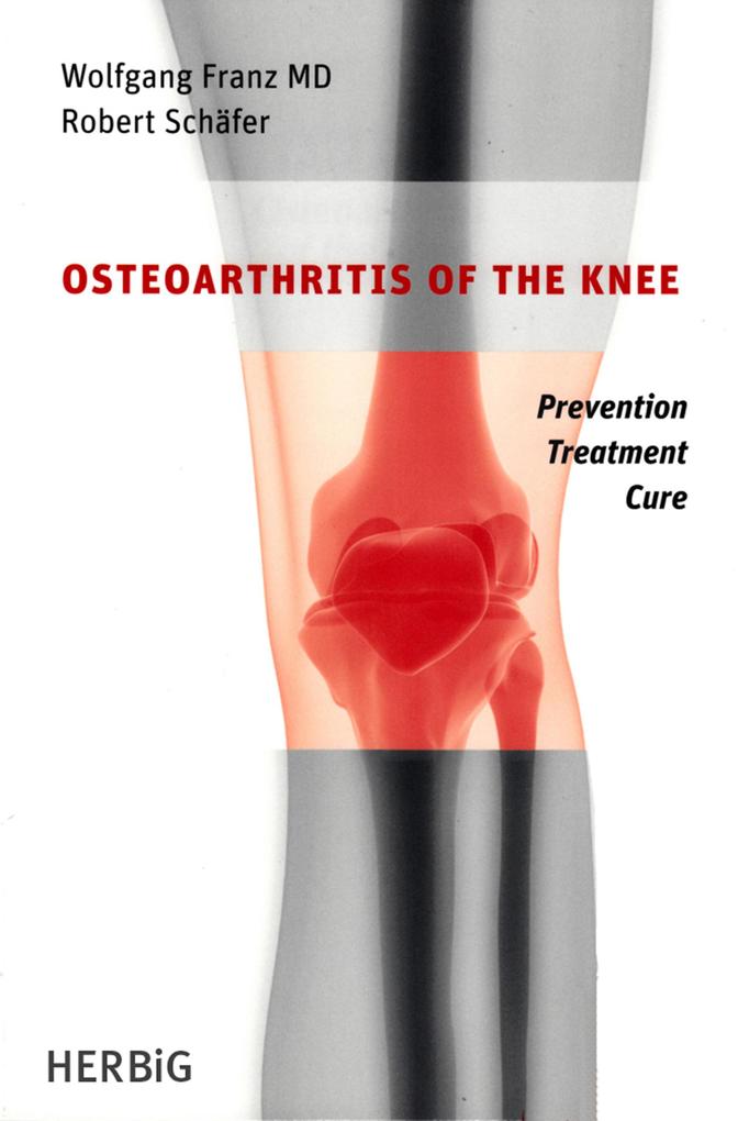 Osteoarthritis of the knee - Wolfgang Franz/ Robert Schäfer