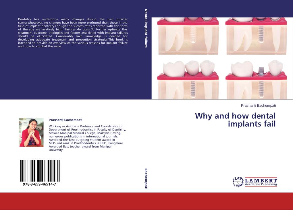 Why and how dental implants fail