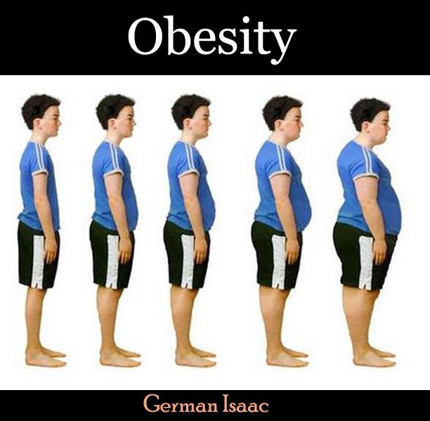 Obesity