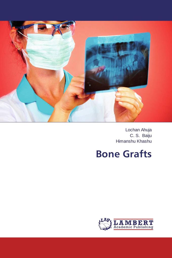 Bone Grafts