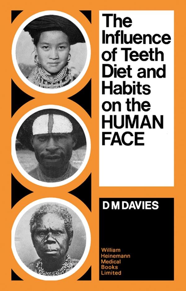 The Influence of Teeth Diet and Habits on the Human Face
