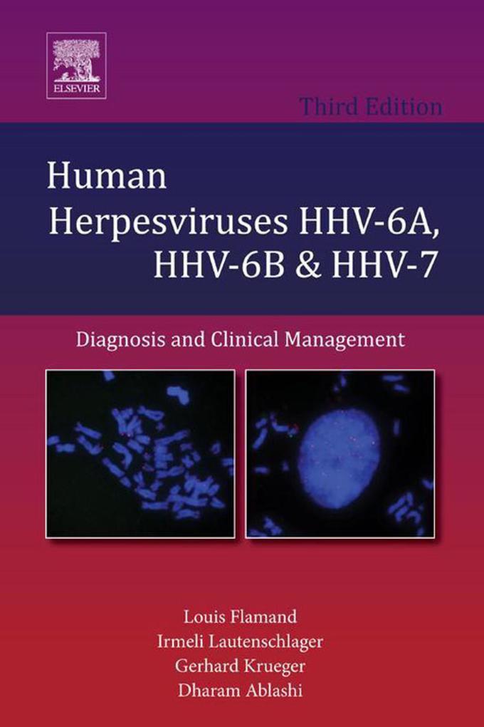 Human Herpesviruses HHV-6A HHV-6B and HHV-7