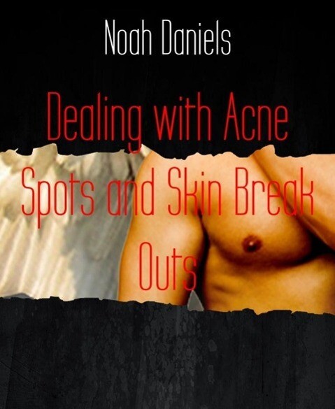 Dealing with Acne Spots and Skin Break Outs