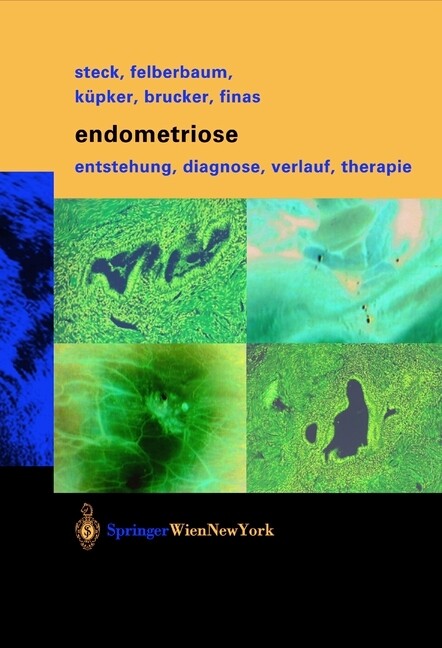 Endometriose - Thomas Steck/ Ricardo E. Felberbaum/ Wolfgang Küpker/ Cosima Brucker/ Dominique F. Finas