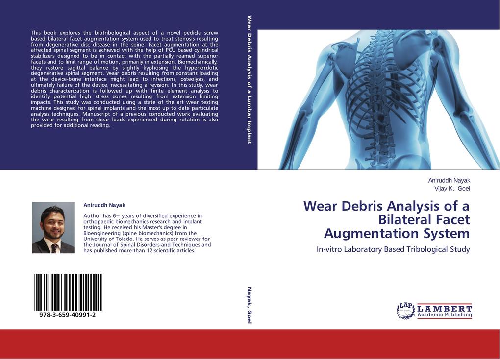 Wear Debris Analysis of a Bilateral Facet Augmentation System