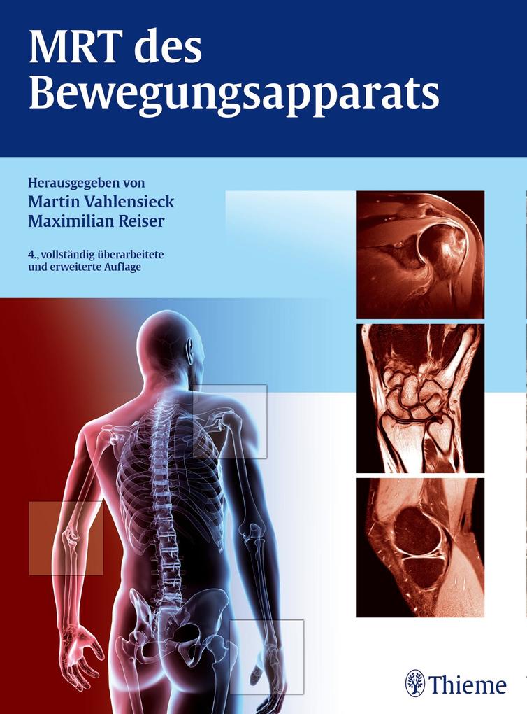 Georg Thieme Verlag Mrt Des Bewegungsapparats