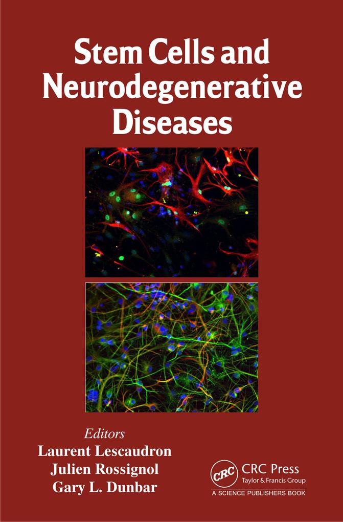 Stem Cells and Neurodegenerative Diseases