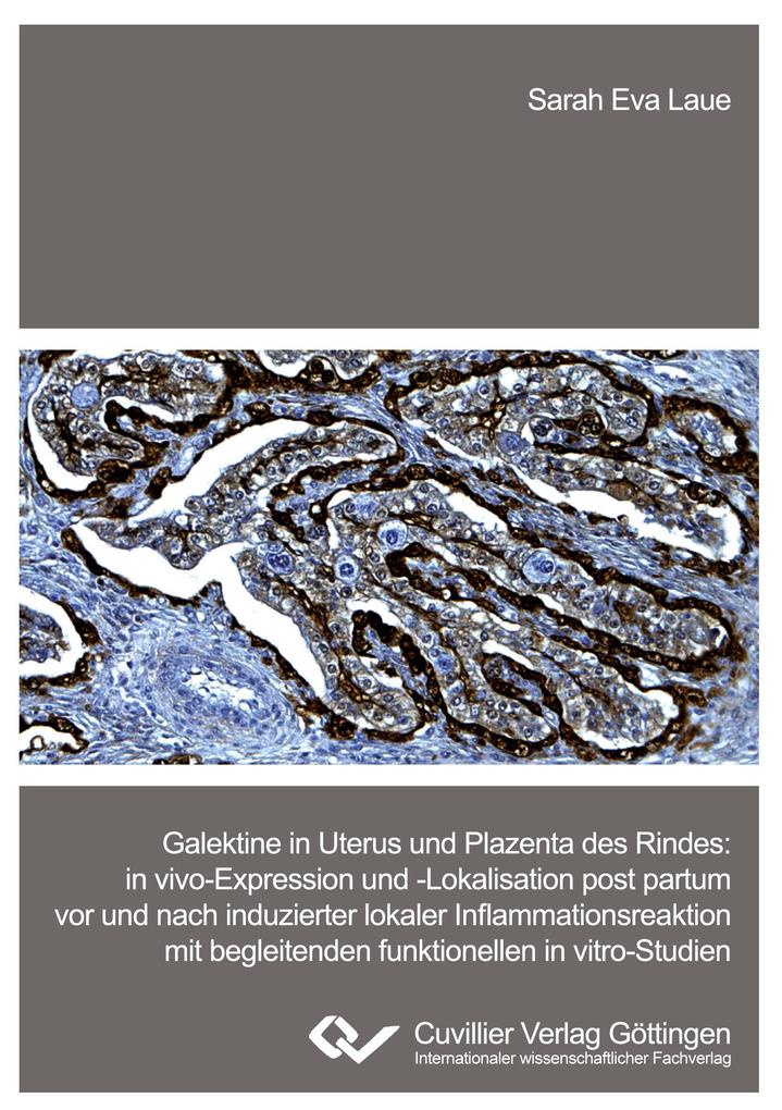 Galektine in Uterus und Plazenta des Rindes. in vivo-Expression und -Lokalisation post partum vor und nach induzierter lokaler Inflammationsreaktion mit begleitenden funktionellen in vitro-Studien