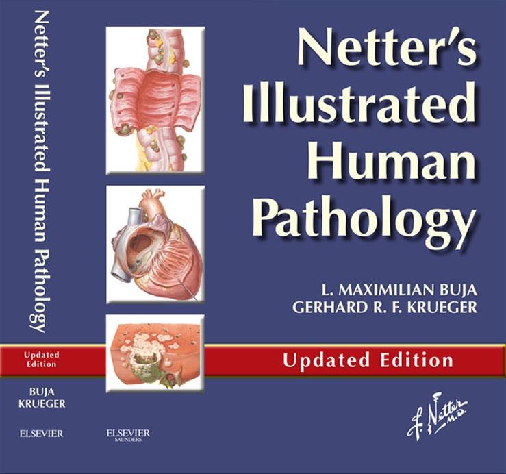 Netter‘s Illustrated Human Pathology Updated Edition E-book