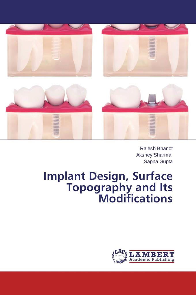 Implant Design Surface Topography and Its Modifications