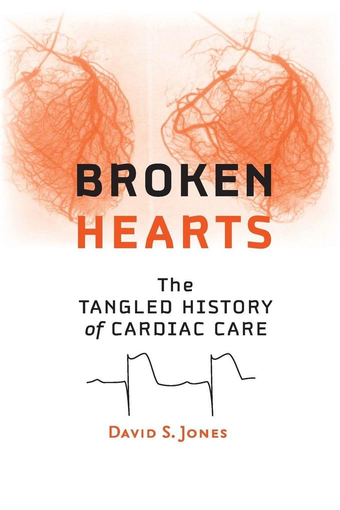 Broken Hearts