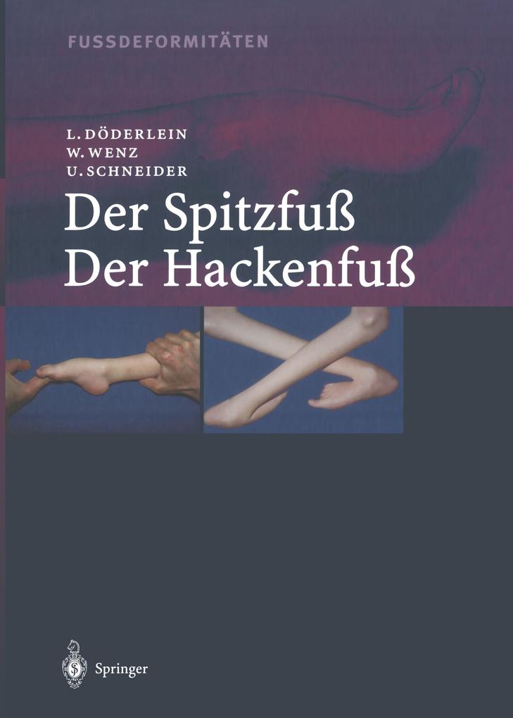 Fussdeformitäten