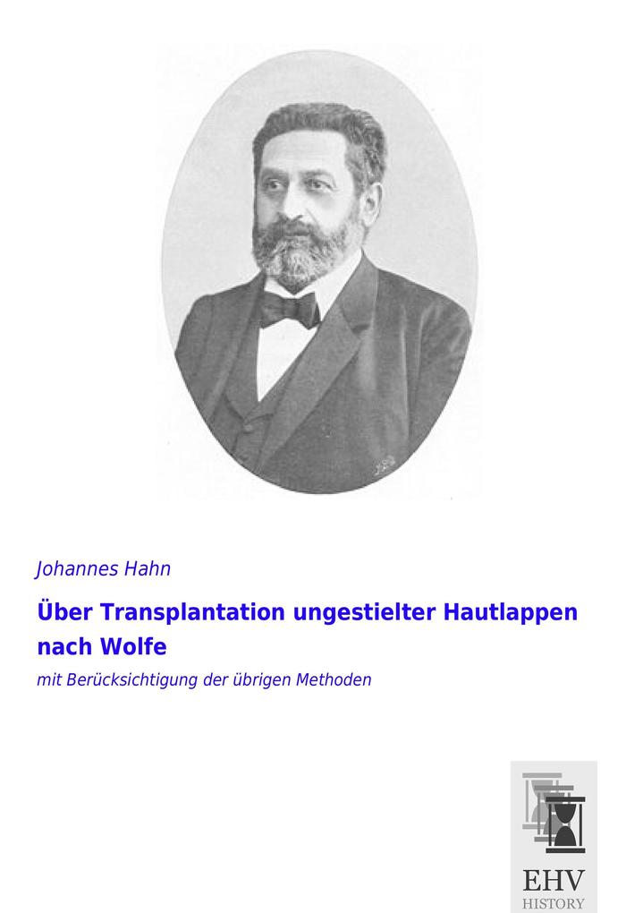 Über Transplantation ungestielter Hautlappen nach Wolfe