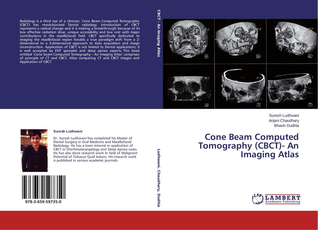 Cone Beam Computed Tomography (CBCT)- An Imaging Atlas