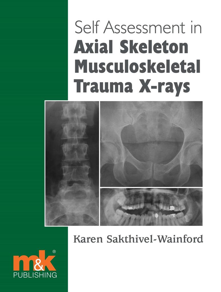 Self-assessment in Axial Musculoskeletal Trauma X-rays
