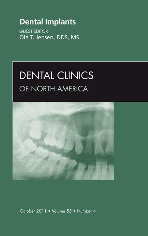 Dental Implants An Issue of Dental Clinics
