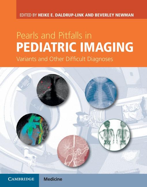 Pearls and Pitfalls in Pediatric Imaging