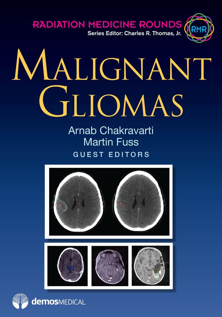 Malignant Gliomas