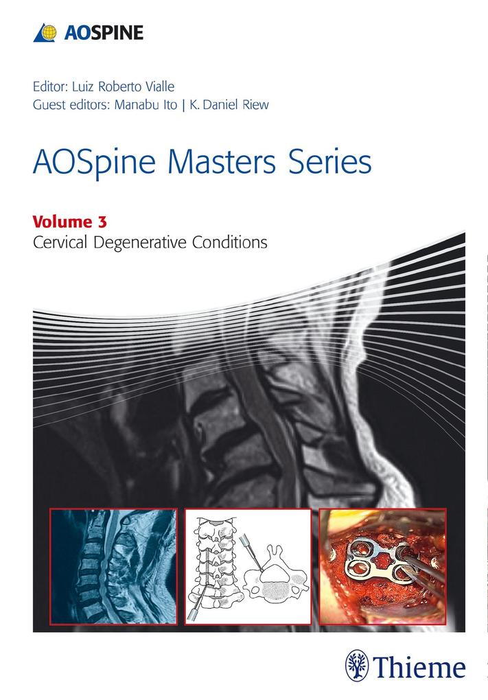 Aospine Masters Series Volume 3: Cervical Degenerative Conditions