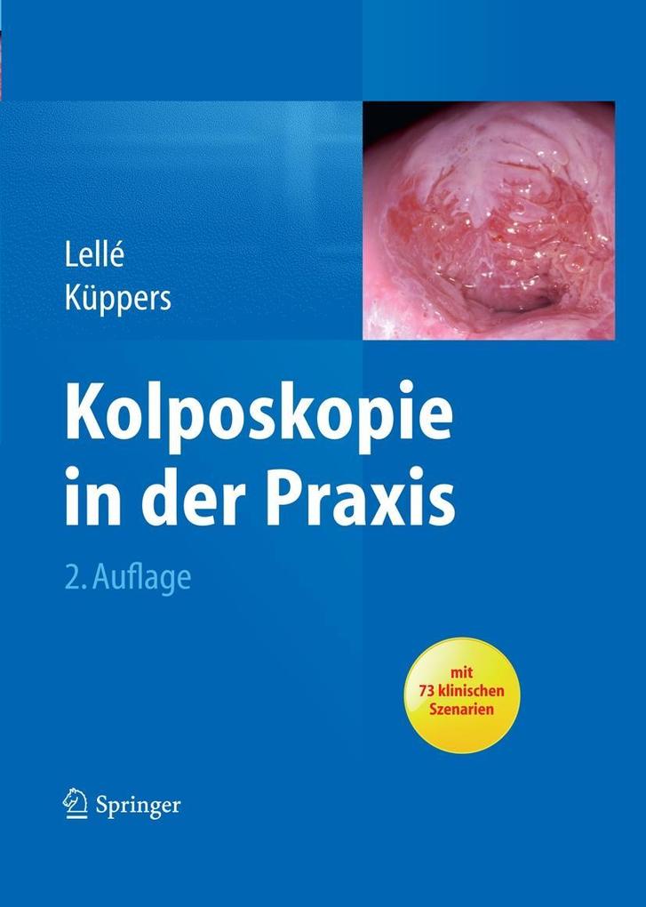 Kolposkopie in der Praxis