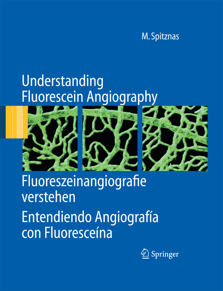 Understanding Fluorescein Angiography Fluoreszeinangiografie verstehen Entendiendo Angiografía con Fluoresceína