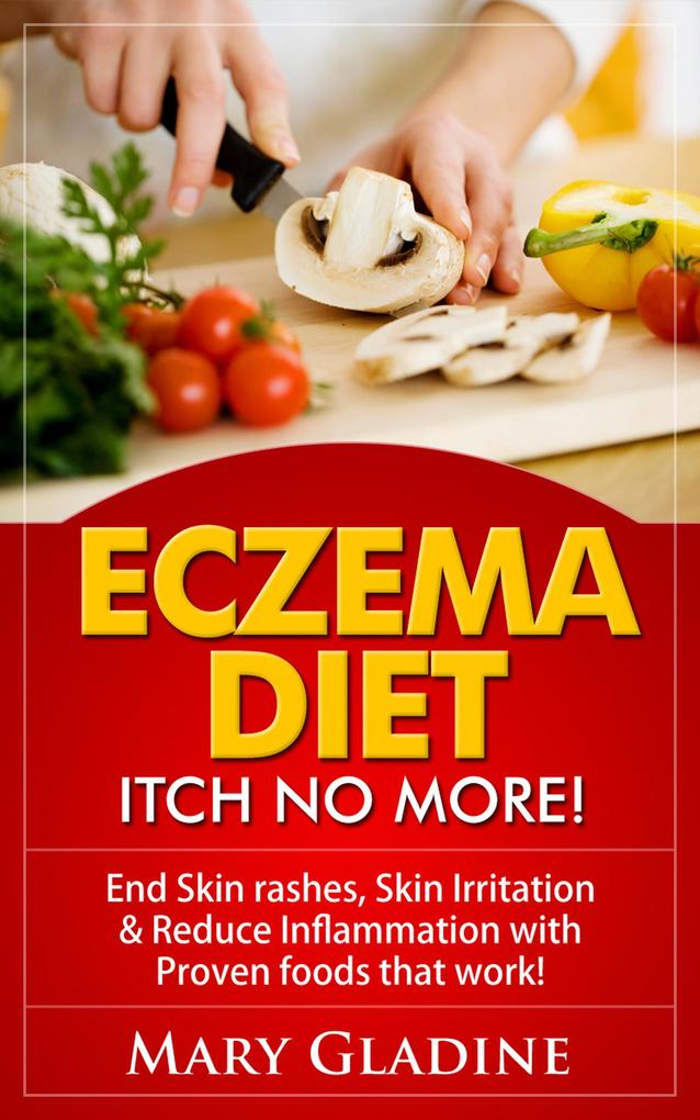 Eczema Diet: Itch No More! End Skin rashes skin irritation & reduce inflammation with A Low Inflammation Diet & Proven foods that work! BONUS know what to avoid!