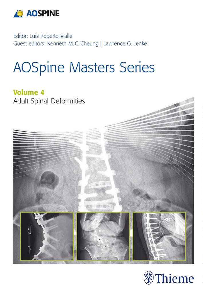 AOSpine Masters Series Volume 4: Adult Spinal Deformities
