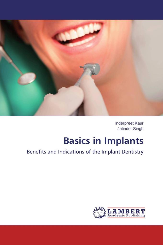 Basics in Implants