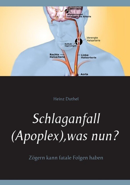 Schlaganfall (Apoplex) was nun?