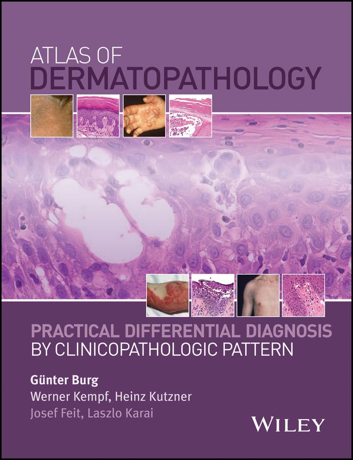 Atlas of Dermatopathology