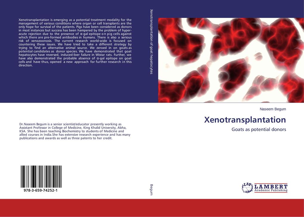 Xenotransplantation