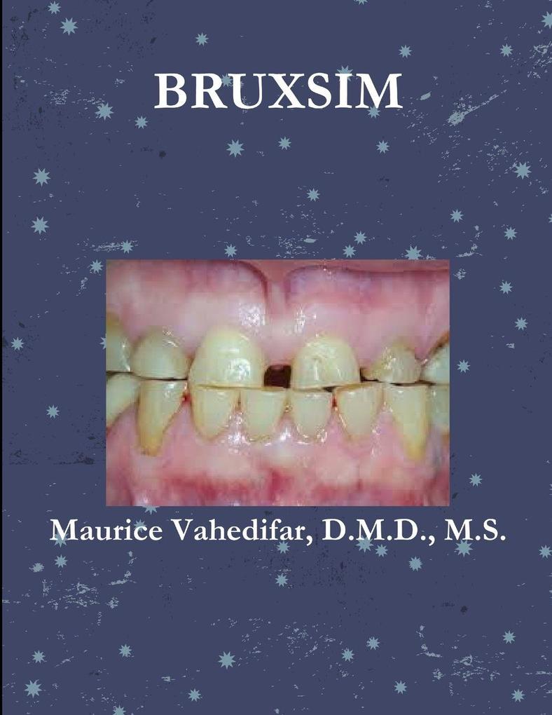 BRUXSIM