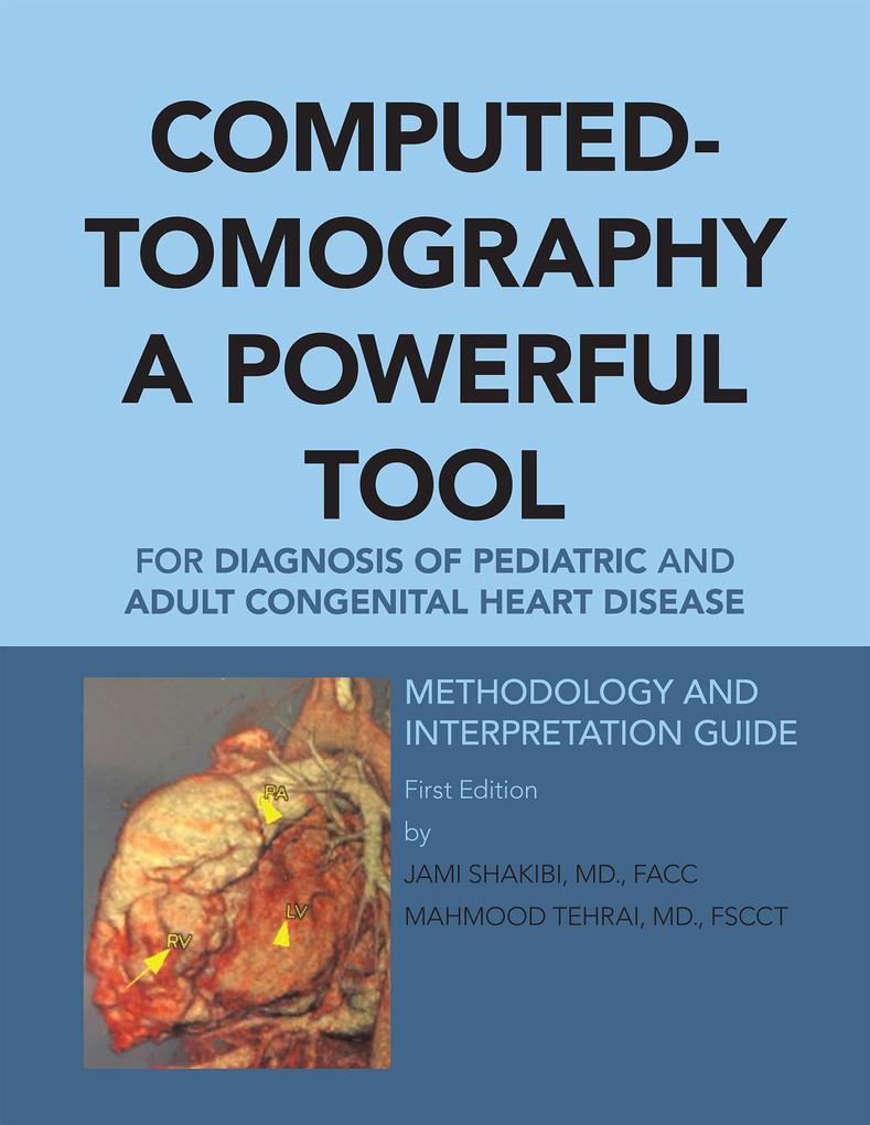 Computed-Tomography a Powerful Tool for Diagnosis of Pediatric and Adult Congenital Heart Disease