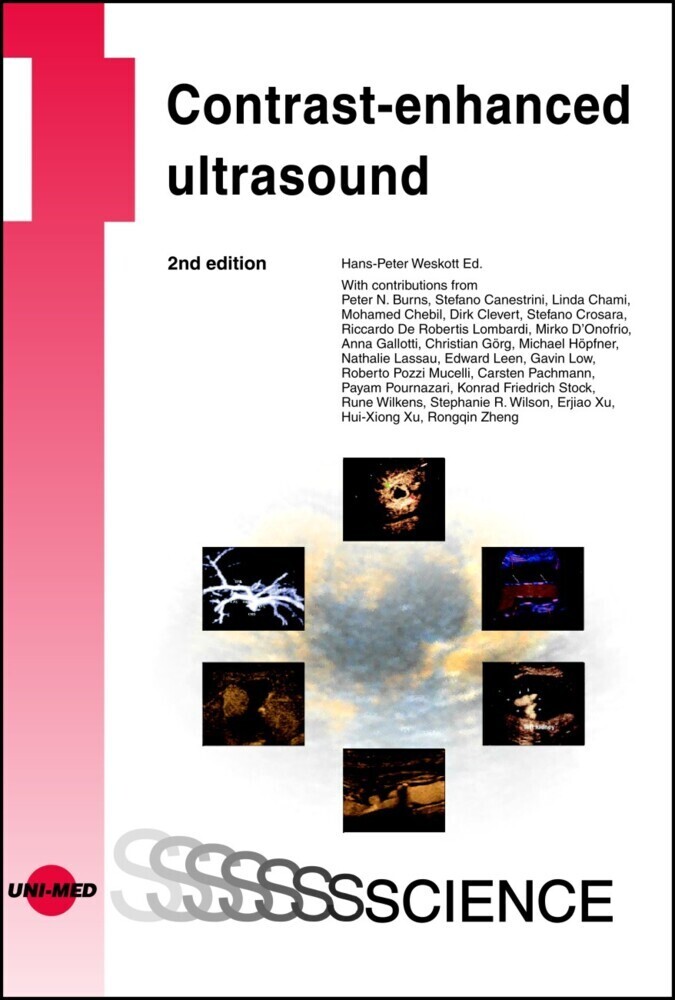 Contrast-enhanced ultrasound