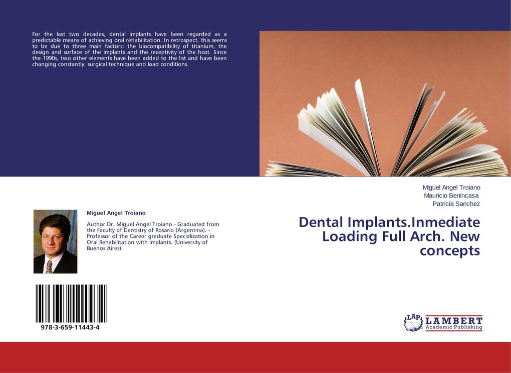 Dental Implants.Inmediate Loading Full Arch. New concepts