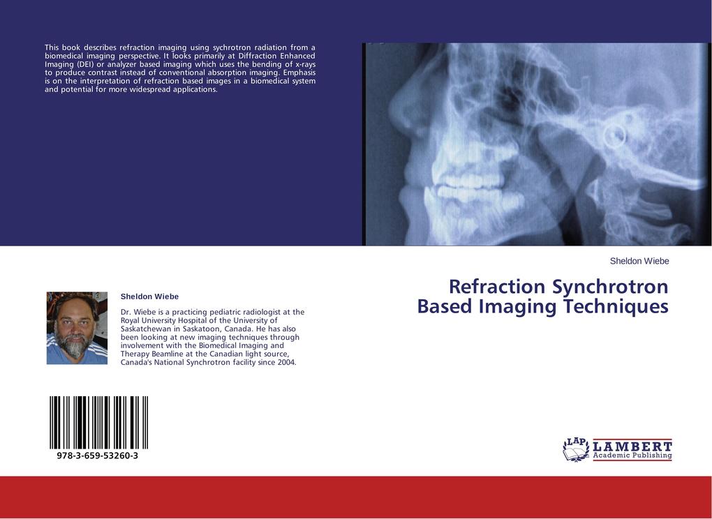 Refraction Synchrotron Based Imaging Techniques