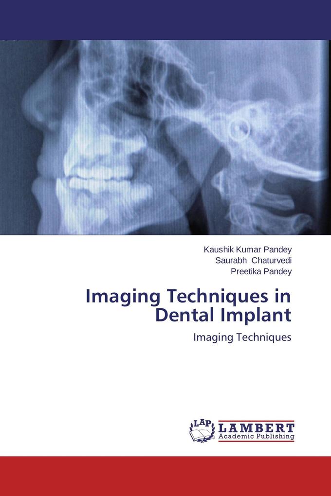 Imaging Techniques in Dental Implant