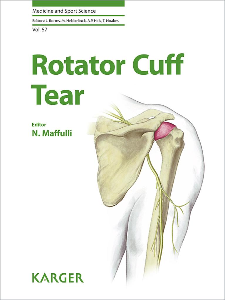 Rotator Cuff Tear