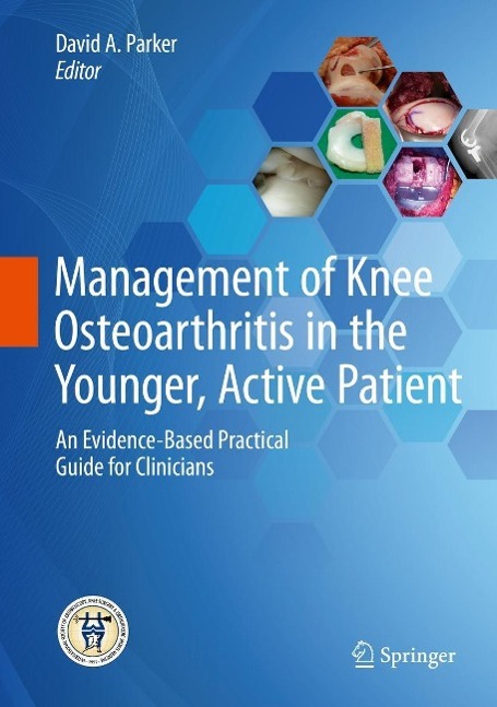Management of Knee Osteoarthritis in the Younger Active Patient