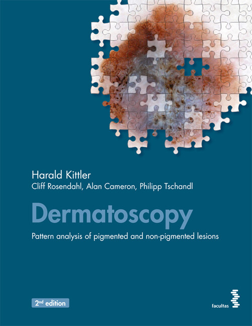 Dermatoscopy - Harald Kittler/ Cliff Rosendahl/ Alan Cameron/ Philipp Tschandl