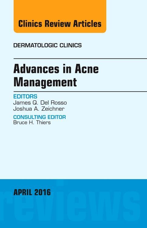 Advances in Acne Management An Issue of Dermatologic Clinics