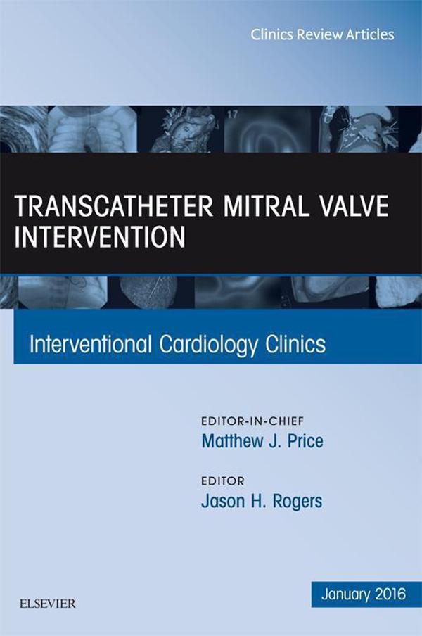 Transcatheter Mitral Valve Intervention An Issue of Interventional Cardiology Clinics