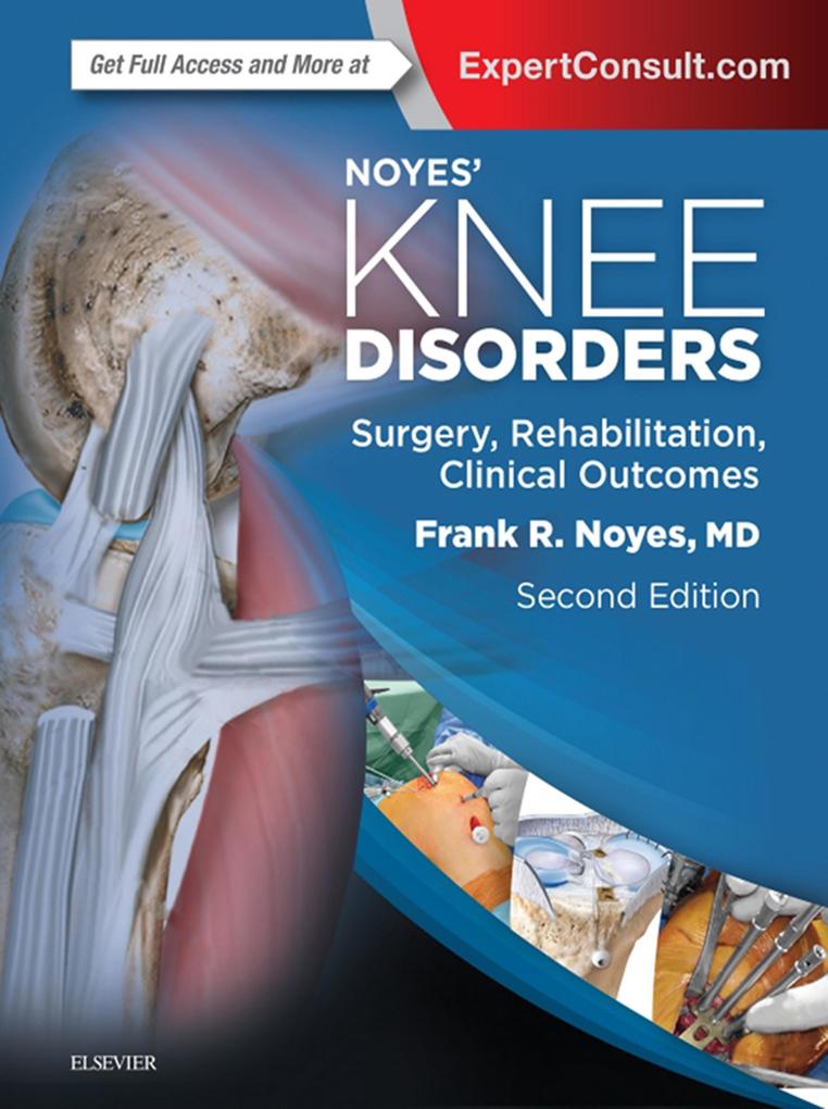 Noyes' Knee Disorders: Surgery Rehabilitation Clinical Outcomes E-Book