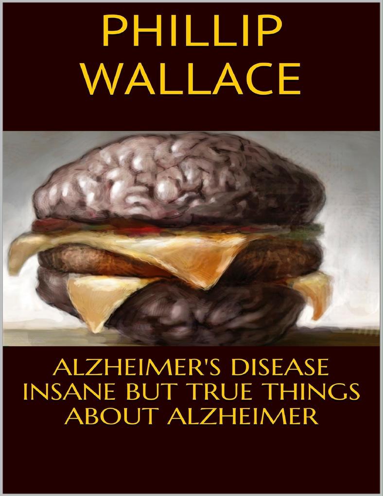 Alzheimer‘s Disease: Insane But True Things About Alzheimer