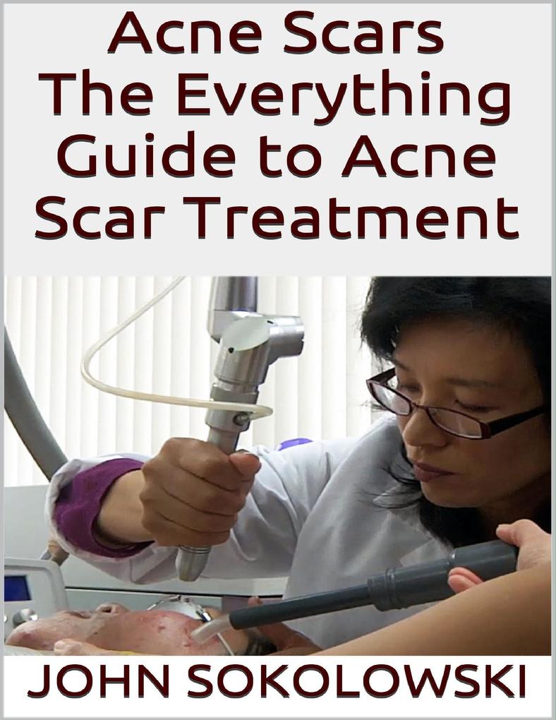 Acne Scars: The Everything Guide to Acne Scar Treatment