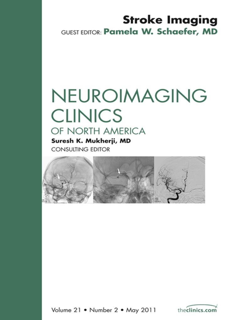 Imaging of Ischemic Stroke An Issue of Neuroimaging Clinics