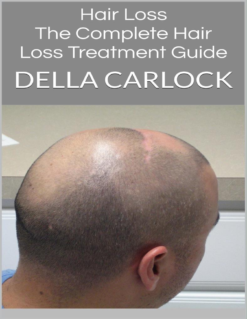 Hair Loss: The Complete Hair Loss Treatment Guide