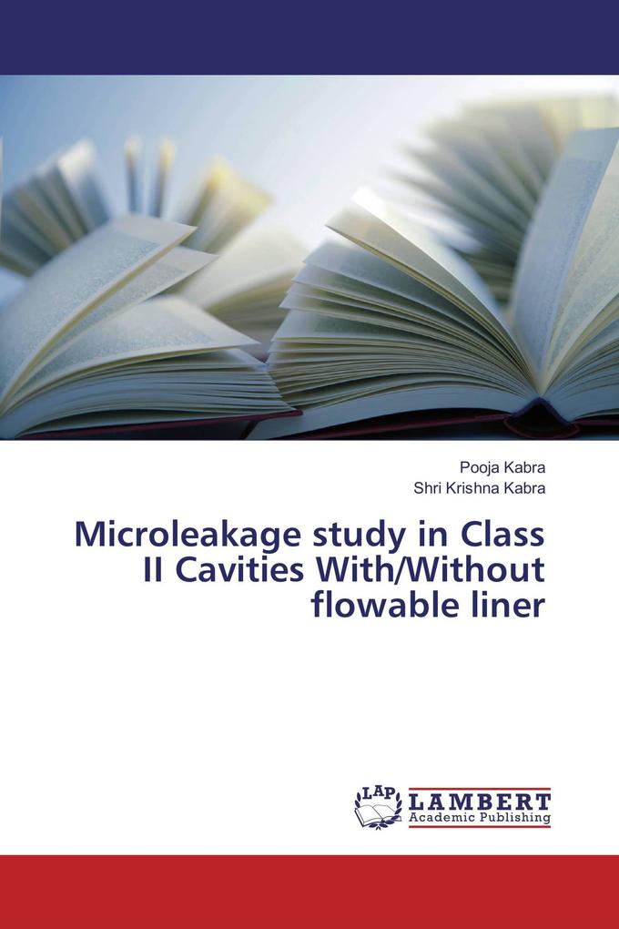 Microleakage study in Class II Cavities With/Without flowable liner