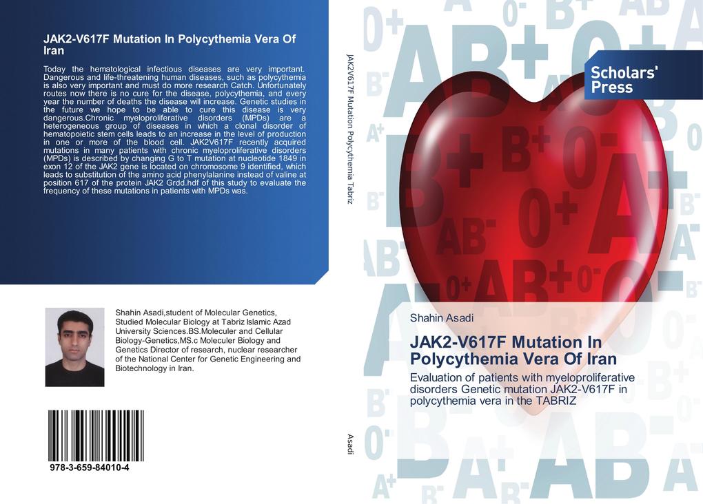 JAK2-V617F Mutation In Polycythemia Vera Of Iran